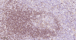CD22 Antibody in Immunohistochemistry (Paraffin) (IHC (P))