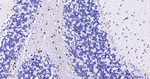 SOX10 Antibody in Immunohistochemistry (Paraffin) (IHC (P))