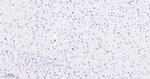 SOX10 Antibody in Immunohistochemistry (Paraffin) (IHC (P))
