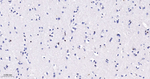 SOX10 Antibody in Immunohistochemistry (Paraffin) (IHC (P))