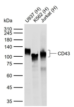 CD43 Recombinant Rabbit Monoclonal Antibody (H6G11)