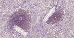CD79b Antibody in Immunohistochemistry (Paraffin) (IHC (P))