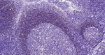 CD79b Antibody in Immunohistochemistry (Paraffin) (IHC (P))