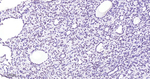 Nkx2.1 Antibody in Immunohistochemistry (Paraffin) (IHC (P))