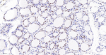 Nkx2.1 Antibody in Immunohistochemistry (Paraffin) (IHC (P))
