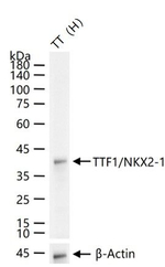 Nkx2.1 Antibody in Western Blot (WB)