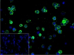 CD21 Recombinant Rabbit Monoclonal Antibody (C12B9)