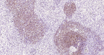 CD21 Antibody in Immunohistochemistry (Paraffin) (IHC (P))