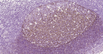 CD21 Antibody in Immunohistochemistry (Paraffin) (IHC (P))