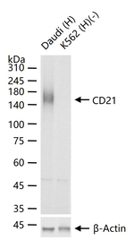 CD21 Antibody in Western Blot (WB)