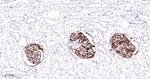 CD35 Antibody in Immunohistochemistry (Paraffin) (IHC (P))