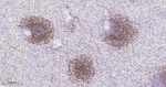 CD35 Antibody in Immunohistochemistry (Paraffin) (IHC (P))