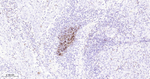 CD35 Antibody in Immunohistochemistry (Paraffin) (IHC (P))