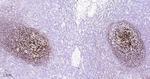 CD35 Antibody in Immunohistochemistry (Paraffin) (IHC (P))