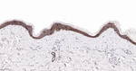 Claudin 1 Antibody in Immunohistochemistry (Paraffin) (IHC (P))