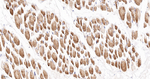 Desmin Antibody in Immunohistochemistry (Paraffin) (IHC (P))