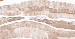 Desmin Antibody in Immunohistochemistry (Paraffin) (IHC (P))