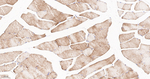 Desmin Antibody in Immunohistochemistry (Paraffin) (IHC (P))