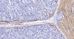 Desmin Antibody in Immunohistochemistry (Paraffin) (IHC (P))