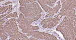 Desmin Antibody in Immunohistochemistry (Paraffin) (IHC (P))