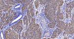 Desmin Antibody in Immunohistochemistry (Paraffin) (IHC (P))