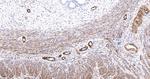 Desmin Antibody in Immunohistochemistry (Paraffin) (IHC (P))