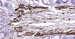 Desmin Antibody in Immunohistochemistry (Paraffin) (IHC (P))