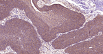 Desmin Antibody in Immunohistochemistry (Paraffin) (IHC (P))