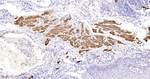 Desmin Antibody in Immunohistochemistry (Paraffin) (IHC (P))