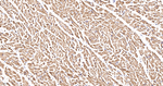 Desmin Antibody in Immunohistochemistry (Paraffin) (IHC (P))
