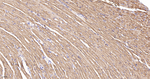Desmin Antibody in Immunohistochemistry (Paraffin) (IHC (P))