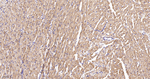 Desmin Antibody in Immunohistochemistry (Paraffin) (IHC (P))