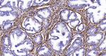 Desmin Antibody in Immunohistochemistry (Paraffin) (IHC (P))