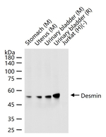 Desmin Antibody in Western Blot (WB)