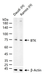 BTK Antibody in Western Blot (WB)