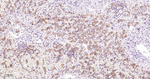Tensin 4 Recombinant Rabbit Monoclonal Antibody (C5F6)