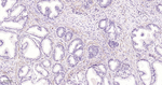 Tensin 4 Antibody in Immunohistochemistry (Paraffin) (IHC (P))