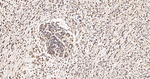 MAGE1 Antibody in Immunohistochemistry (Paraffin) (IHC (P))