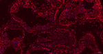 MAGE1 Antibody in Immunohistochemistry (Paraffin) (IHC (P))
