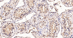 MAGE1 Antibody in Immunohistochemistry (Paraffin) (IHC (P))