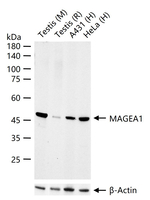 MAGE1 Antibody in Western Blot (WB)