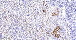 Hemoglobin alpha-1 Recombinant Rabbit Monoclonal Antibody (H8D6)