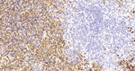 Hemoglobin alpha-1 Antibody in Immunohistochemistry (Paraffin) (IHC (P))