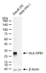 HLA-DPB1 Antibody in Western Blot (WB)