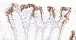 MUC4 Antibody in Immunohistochemistry (Paraffin) (IHC (P))
