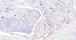 MUC4 Recombinant Rabbit Monoclonal Antibody (M1F3)