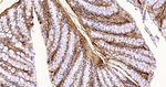 Galectin 1 Antibody in Immunohistochemistry (Paraffin) (IHC (P))