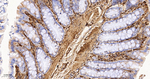 Galectin 1 Antibody in Immunohistochemistry (Paraffin) (IHC (P))