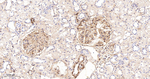 Galectin 1 Recombinant Rabbit Monoclonal Antibody (B6B2)