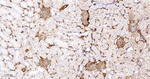 Galectin 1 Antibody in Immunohistochemistry (Paraffin) (IHC (P))